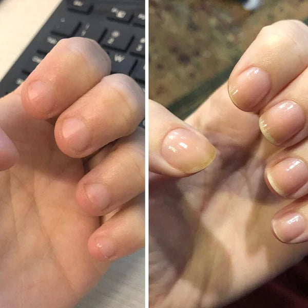 Lirio Nails© - Esmalte para crecimiento de uñas