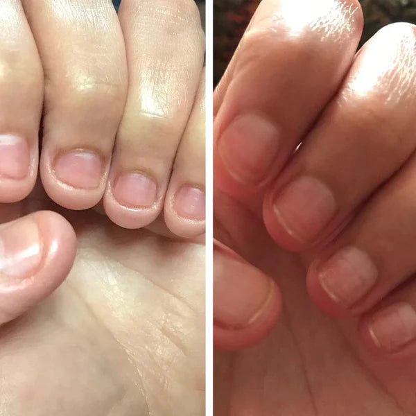 Lirio Nails© - Esmalte para crecimiento de uñas