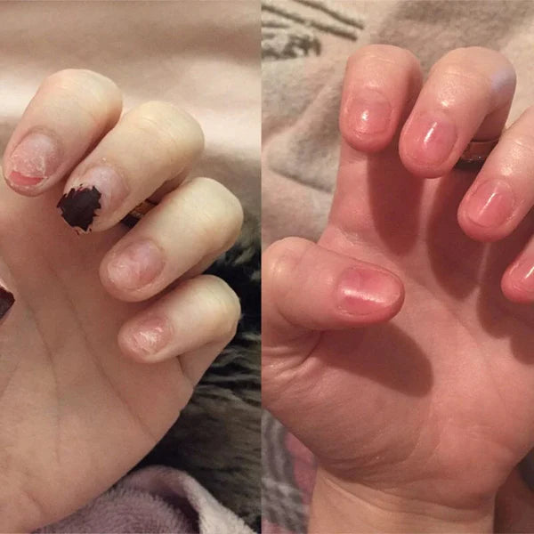 Lirio Nails© - Esmalte para crecimiento de uñas
